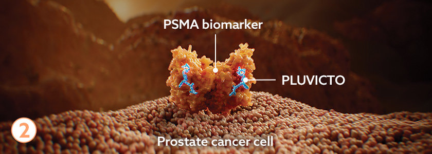 PSMA biomarker, PLUVICTO, and prostate cancer cell