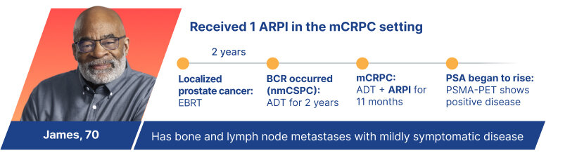 James, 70: has bone/lymph metastases with mildly symptomatic disease. Received 1 ARPI in the mCRPC setting. EBRT, ADT (2y), ADT+ ARPI (11m),PSMA-PET shows positive disease
